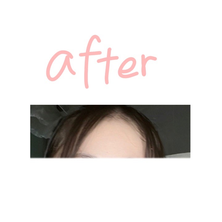 わかたに。 on LIPS 「皆さんこんにちわー☀️わかたに。です!今日は、私の肌改善法につ..」(3枚目)