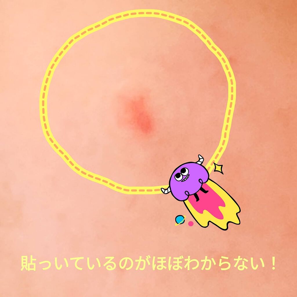 AC SOLUTION CLEAR SPOT PATCH/G9SKIN/にきびパッチを使ったクチコミ（3枚目）