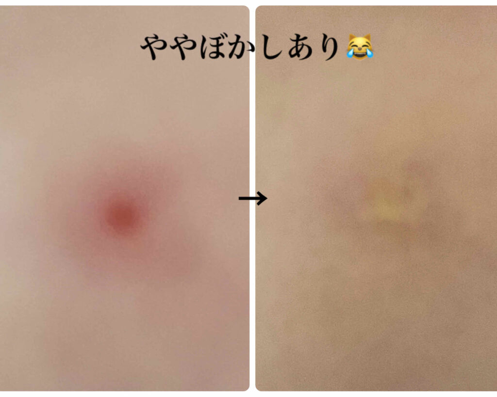 ザ コンシーラー No.21 明るい肌色/MISSHA/リキッドコンシーラーを使ったクチコミ（2枚目）