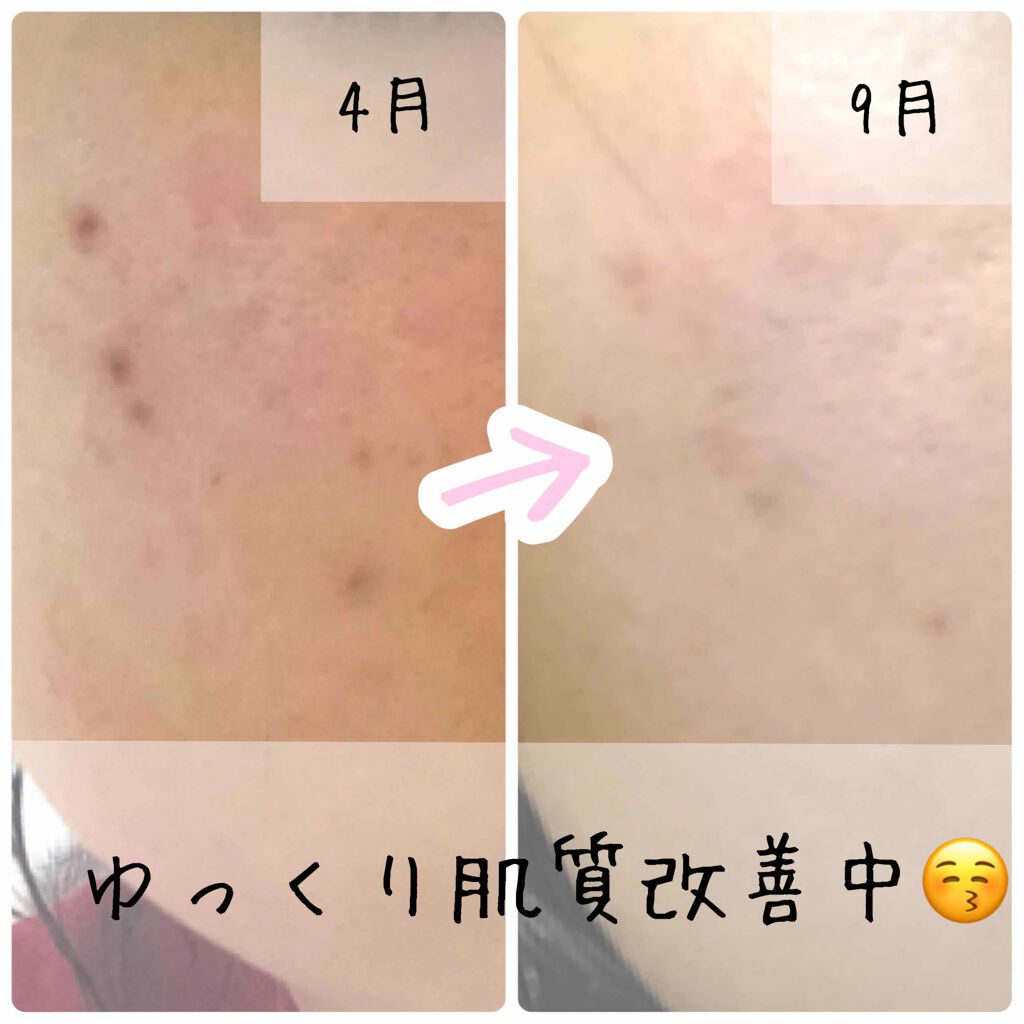 パーフェクトホイップn/SENKA(専科)/洗顔フォームを使ったクチコミ(1枚目)