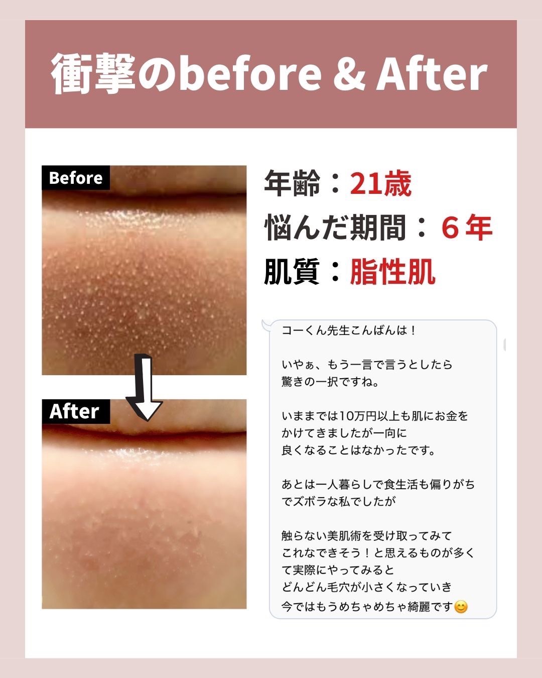 を使ったクチコミ（2枚目）