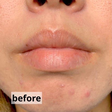 キス クラウド ブロッテッド リップ カラー 014 ブラッシュ マッチ?/REVLON/口紅の画像