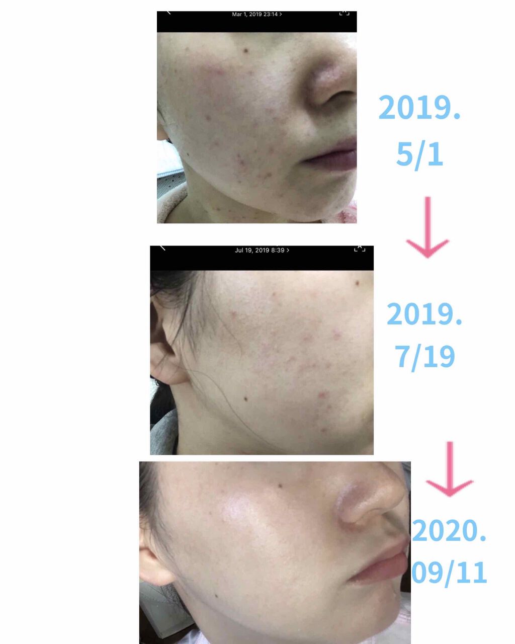 を使ったクチコミ（2枚目）