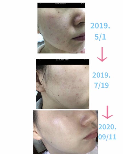 を使ったクチコミ(2枚目)