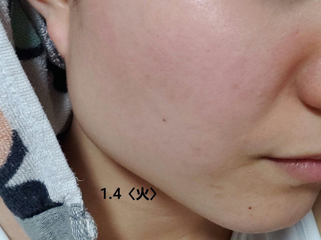 グリーン ダーマCICAビックトナー/ネイチャーリパブリック/化粧水を使ったクチコミ(7枚目)