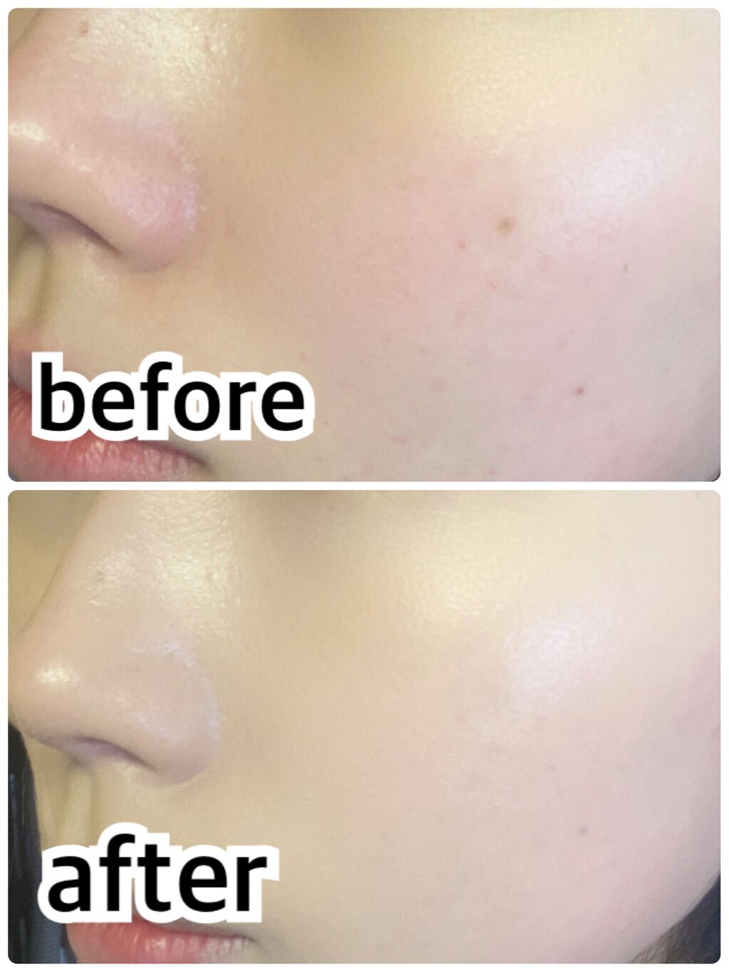 ピンクティーツリーカバークッション/APLIN/クッションファンデーションを使ったクチコミ（1枚目）