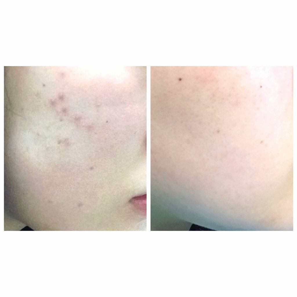 ザ・タイムR アクア/IPSA/化粧水を使ったクチコミ(2枚目)