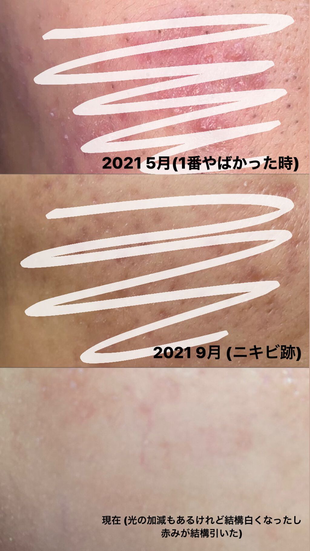 ハトムギ化粧水(ナチュリエ スキンコンディショナー R )/ナチュリエ/化粧水を使ったクチコミ(5枚目)