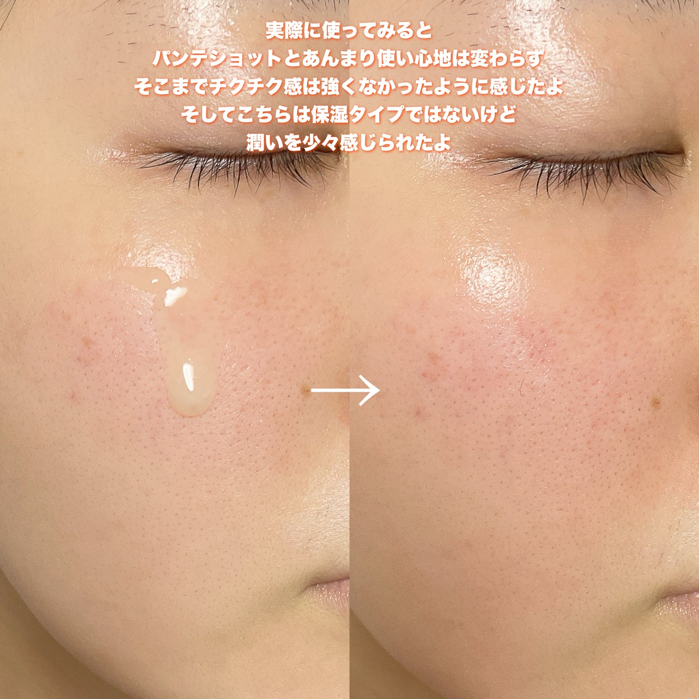 PDRNショット675/COSNORI/美容液を使ったクチコミ(5枚目)