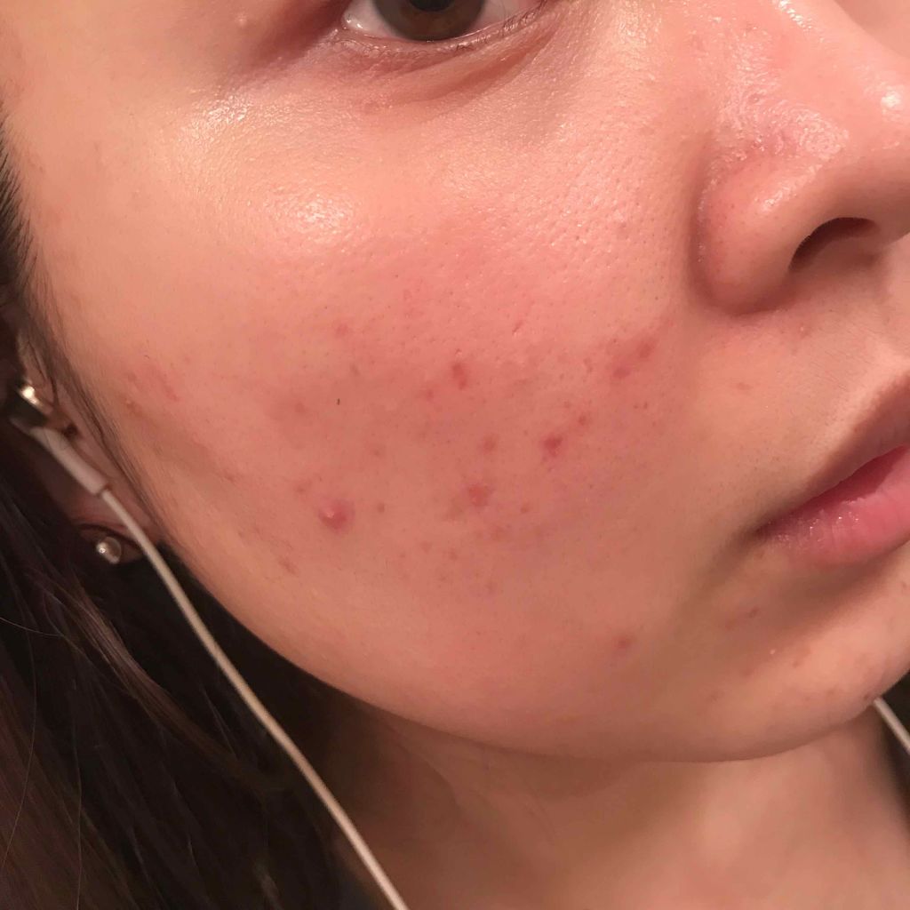 グーダル グリーンタンジェリンビタCセラムマスク/goodal/シートマスク・パックを使ったクチコミ(4枚目)