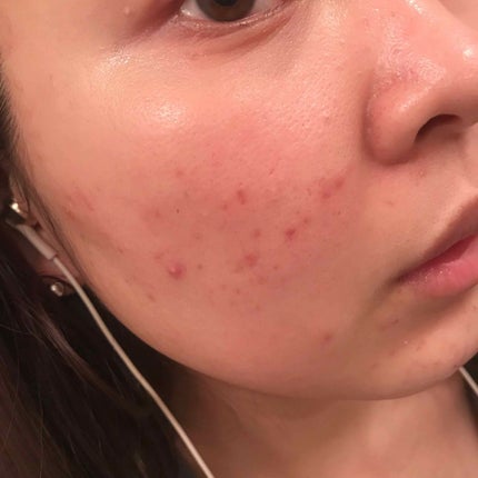 グーダル グリーンタンジェリンビタCセラムマスク/goodal/シートマスク・パックを使ったクチコミ(4枚目)