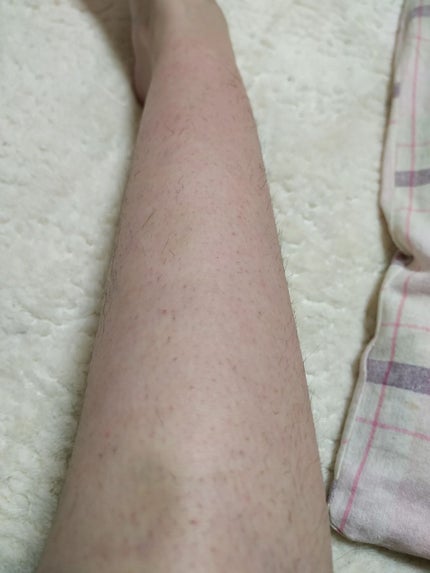 除毛クリーム/DAISO/除毛クリームを使ったクチコミ(3枚目)