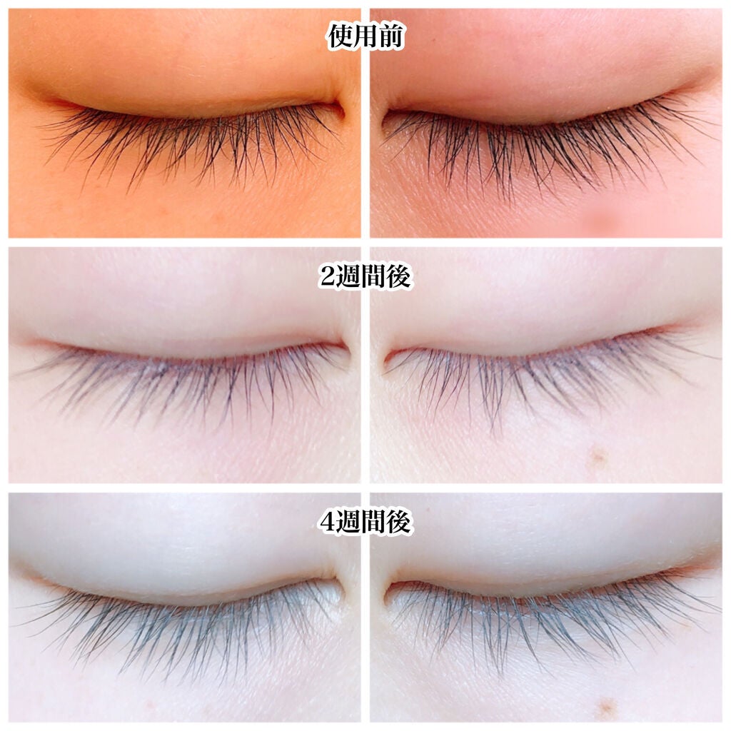 まつげ美容液 トリカアイ(TrichoEye)/HAKURYUDO/その他スキンケアグッズを使ったクチコミ(2枚目)