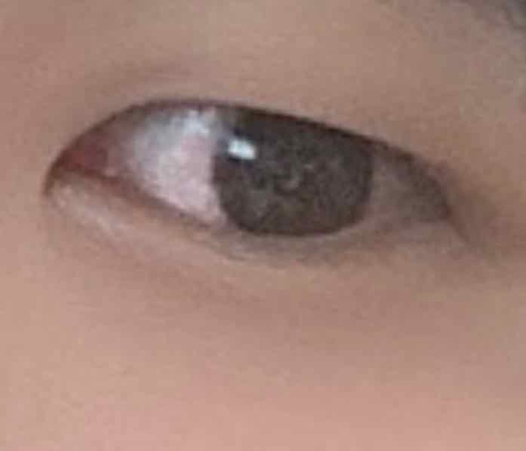 【旧品】オリシキ アイリッドスキンフィルム/D-UP/二重まぶた用アイテムを使ったクチコミ（2枚目）