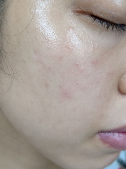 ロゼットゴマージュ/ロゼット/ピーリングを使ったクチコミ(4枚目)