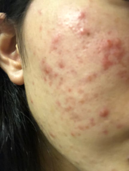 を使ったクチコミ(2枚目)