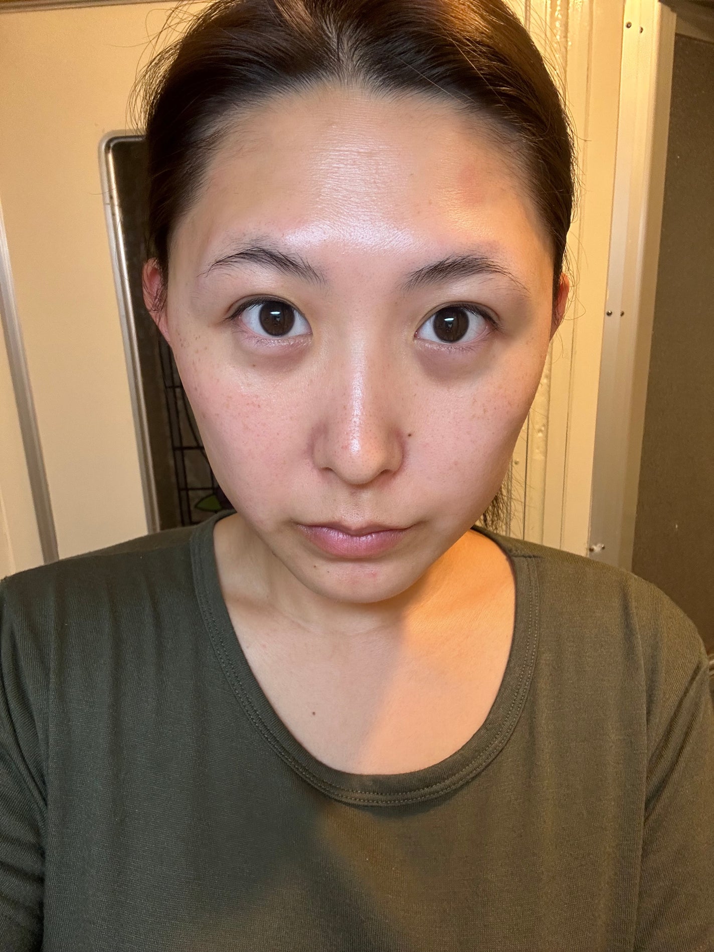 ネイチャーコンク 薬用クリアローション/ネイチャーコンク/拭き取り化粧水を使ったクチコミ(2枚目)