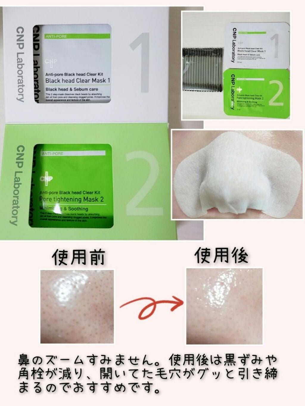 アンチポアブラックヘッドパーフェクトクリアキット/CNP Laboratory/シートマスク・パックを使ったクチコミ(1枚目)