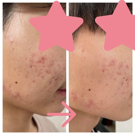 明色美顔水 薬用化粧水/美顔/化粧水を使ったクチコミ(3枚目)