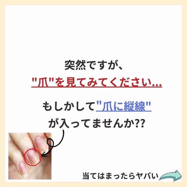 あなたの肌に合ったスキンケア💐コーくん on LIPS 「【実はヤバい。】爪がこんな色の人肌荒れます😭...あなたの毛穴..」（2枚目）