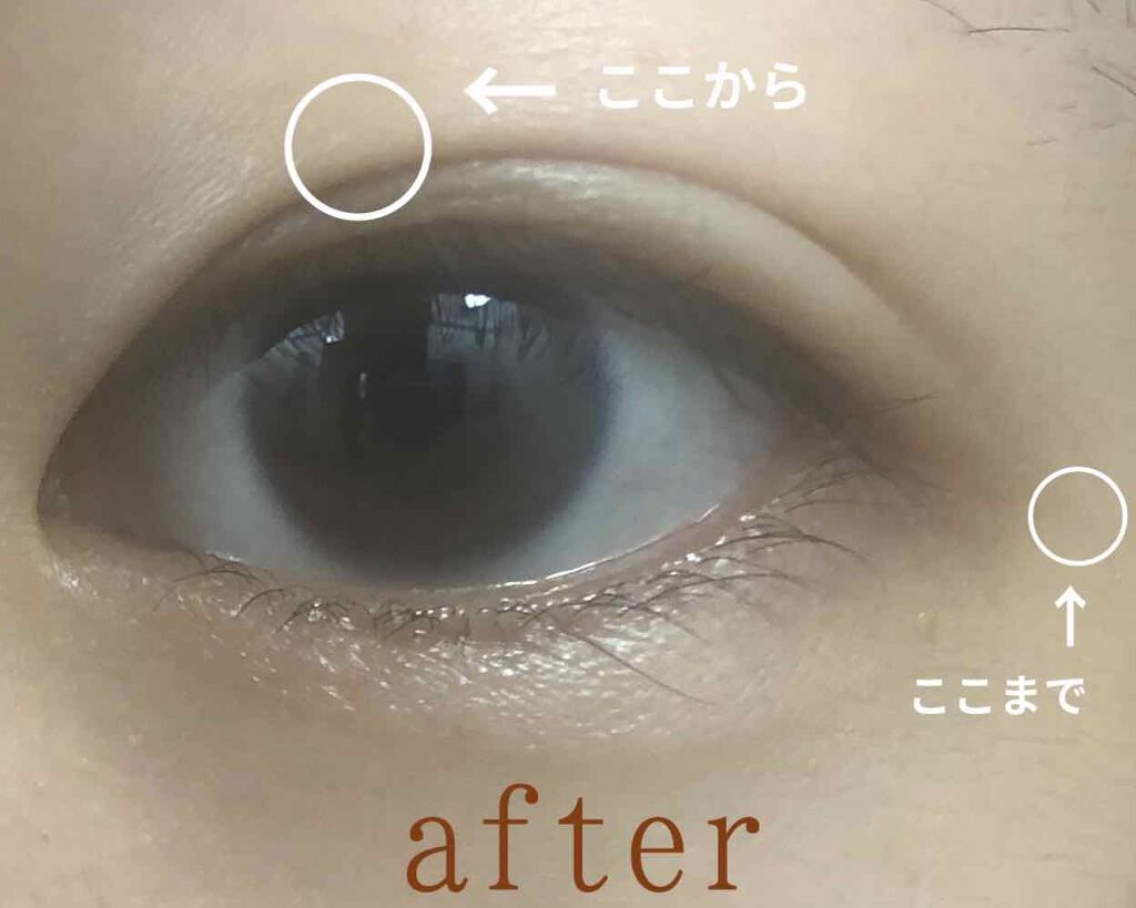 アイテープ(絆創膏タイプ、レギュラー、70枚)/DAISO/二重まぶた用アイテムを使ったクチコミ(3枚目)