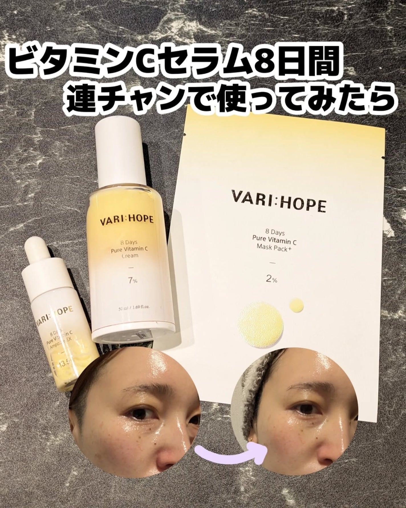 8デイズピュアビタミンCアンプル/VARI:HOPE/美容液を使ったクチコミ(1枚目)