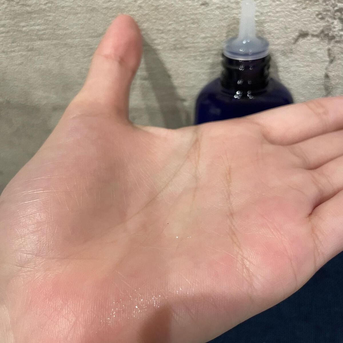 Wアプローチヘアプログラム/MUNOAGE(ミューノアージュ)/頭皮ローションを使ったクチコミ（3枚目）