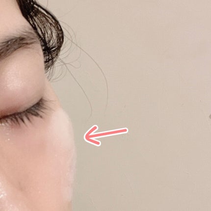 マジックバブルエッセンスパックMINI/BAKER7/シートマスク・パックを使ったクチコミ(4枚目)