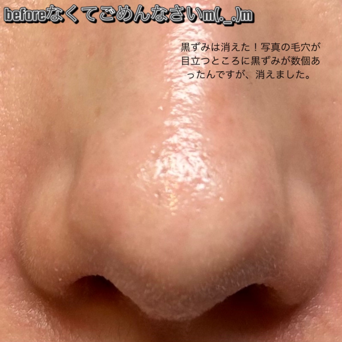 ノーモアブラックヘッド(ノーズピーリング)/One-day's you/スクラブ・ゴマージュを使ったクチコミ（3枚目）