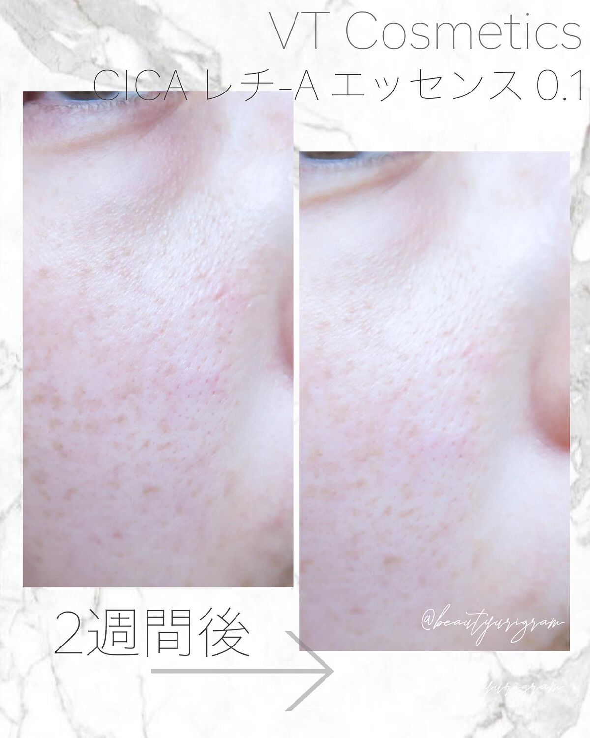 シカマイルドクレンジングバーム/VT/クレンジングバームを使ったクチコミ(4枚目)