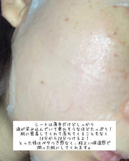ティーツリーオイルパック/NOWATER/シートマスク・パックを使ったクチコミ(4枚目)