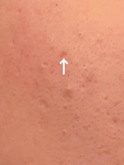 インビジブルピーリングブースターエッセンス/CNP Laboratory/ブースター・導入液を使ったクチコミ(5枚目)