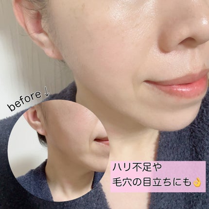 レチノール スーパーバウンス セラム/IOPE/美容液を使ったクチコミ(5枚目)