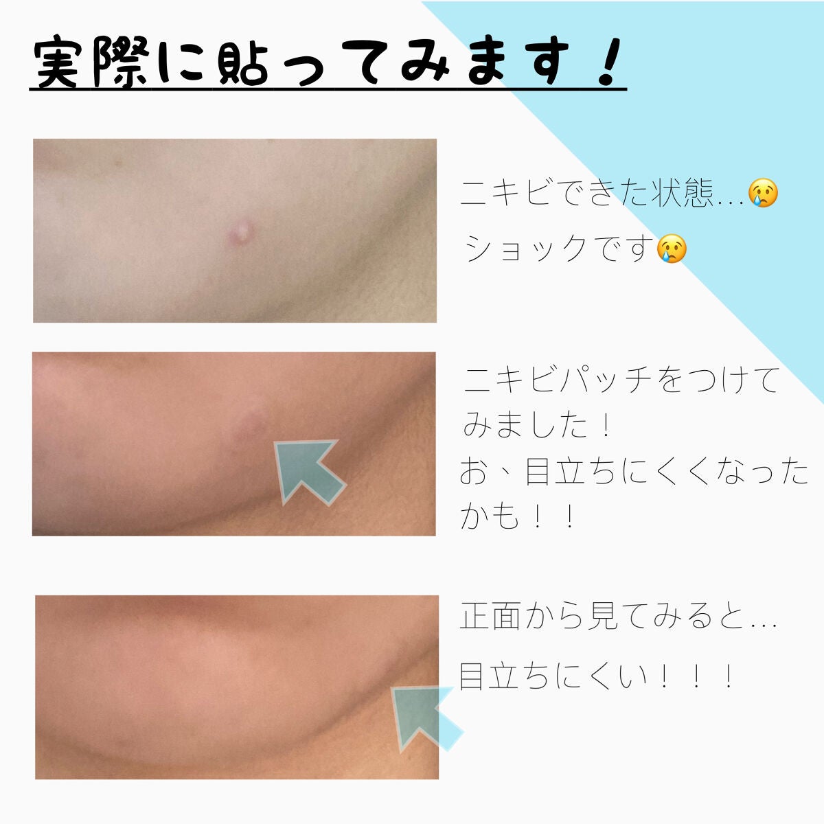 オリーブヤング ケアプラス/Olive Young/その他を使ったクチコミ(4枚目)