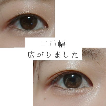 しなやかフィット/DAISO/二重まぶた用アイテムを使ったクチコミ(1枚目)
