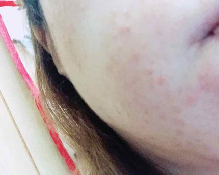 美ルル スキンチェッカー/belulu/美顔器・マッサージを使ったクチコミ(2枚目)