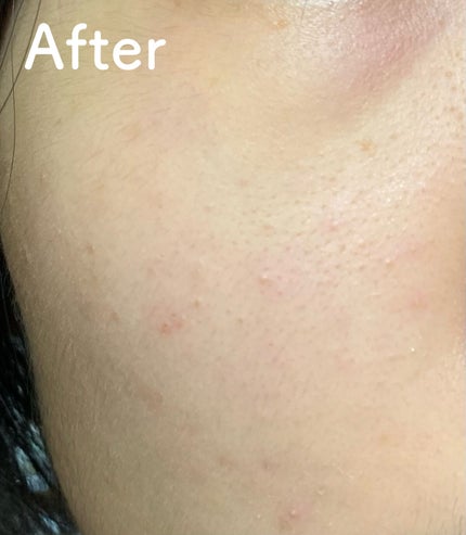 ももぷり フレッシュバブルパック/ももぷり/洗い流すパック・マスクを使ったクチコミ(8枚目)