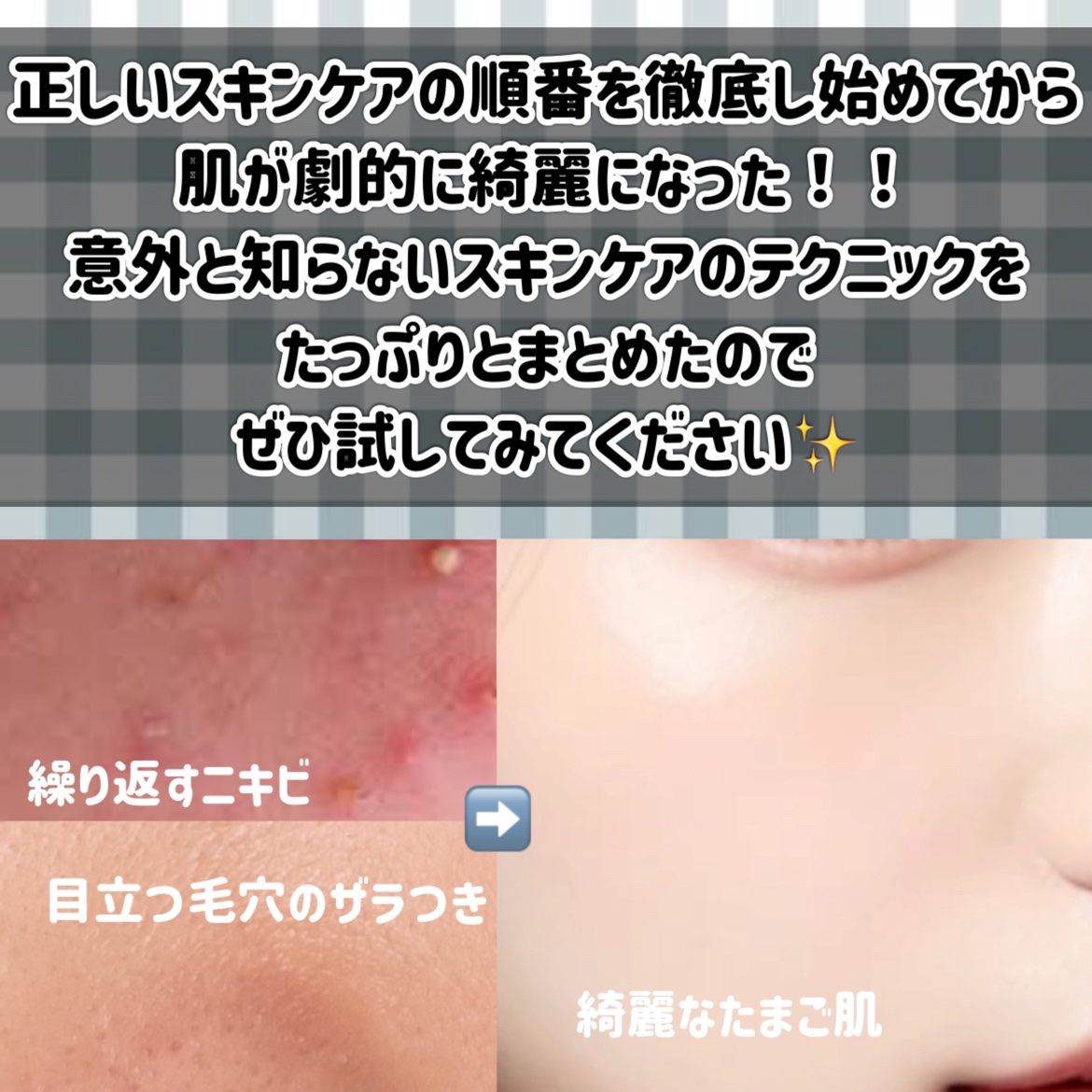 潤いバリア乳液/ももぷり/乳液を使ったクチコミ（2枚目）