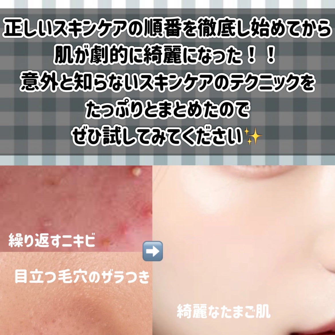 潤浸保湿 フェイスクリーム/キュレル/フェイスクリームを使ったクチコミ(2枚目)