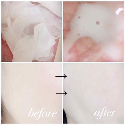 0.2エアフィットマスク/ETUDE/シートマスク・パックを使ったクチコミ(3枚目)