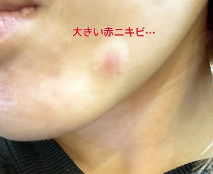 プロCICA クリアスポットパッチ/VT/その他スキンケアを使ったクチコミ(4枚目)