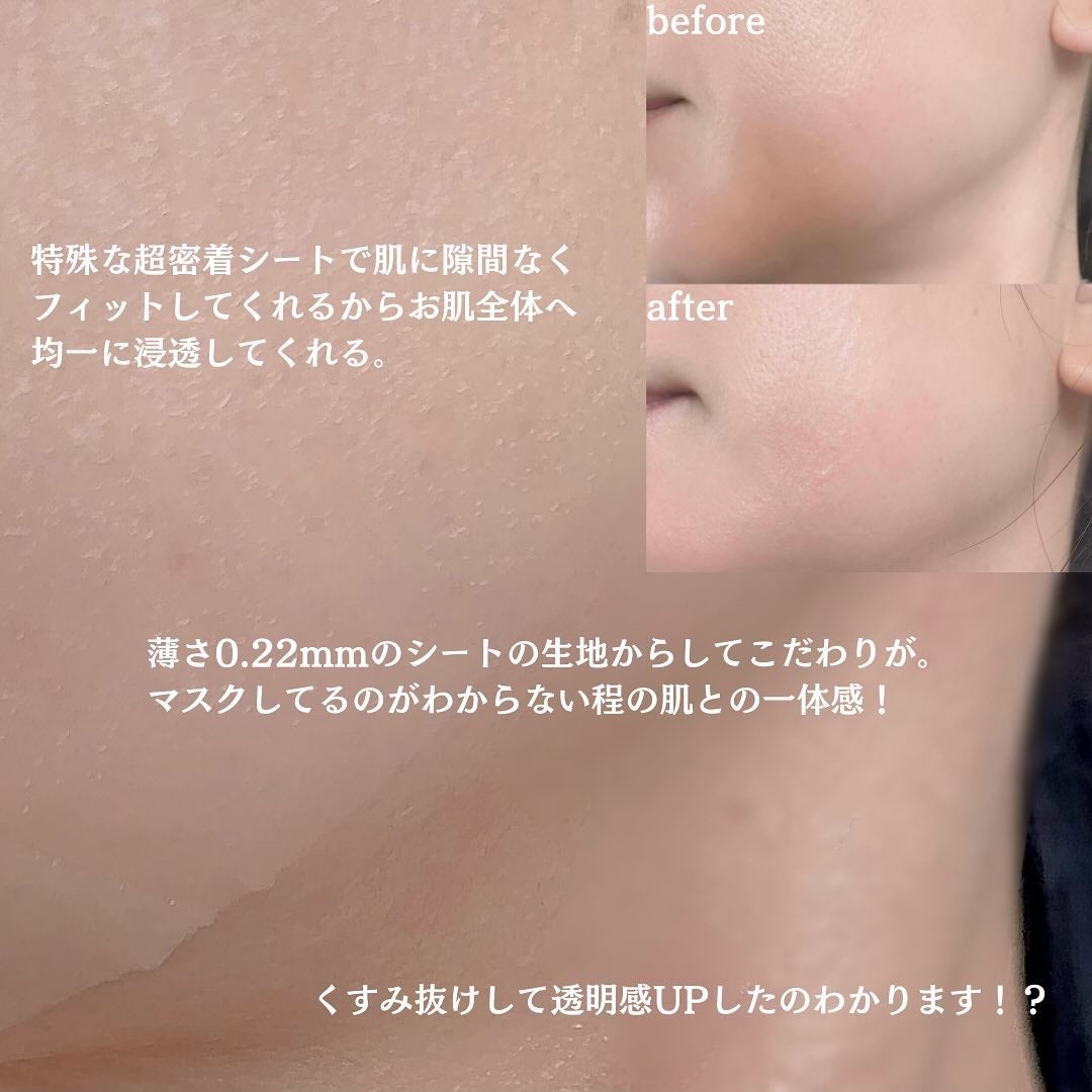 ビタグロウマスク/Dr.Althea/シートマスク・パックを使ったクチコミ(4枚目)