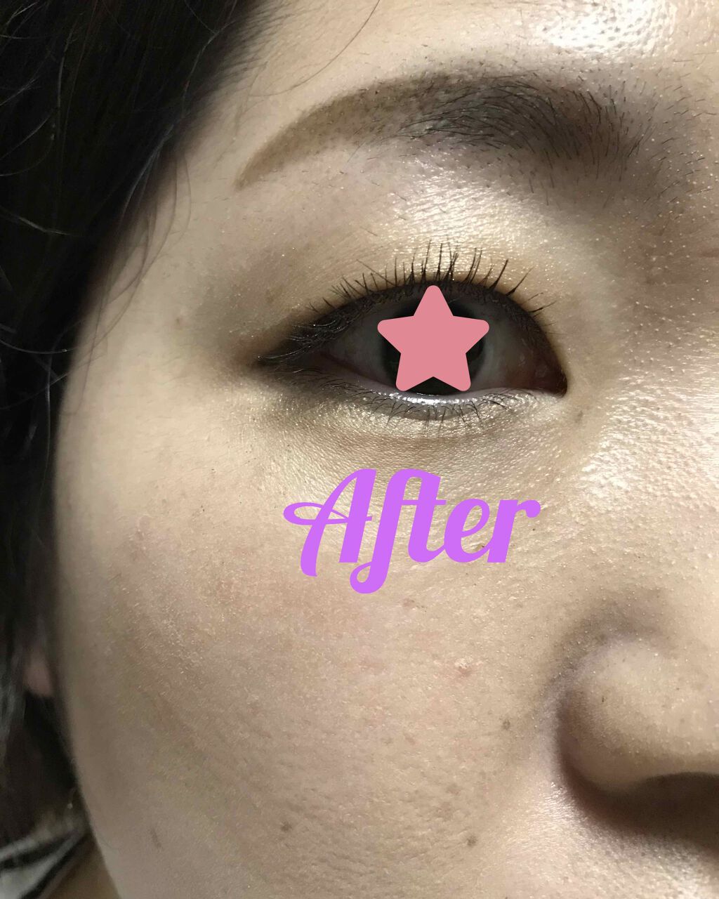 ひとえ・奥ぶたえ用カーラー/アイプチ®/ビューラーを使ったクチコミ（3枚目）