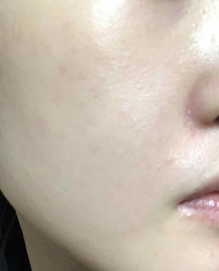 モイスチャライジングセラム/エトヴォス/美容液を使ったクチコミ(5枚目)