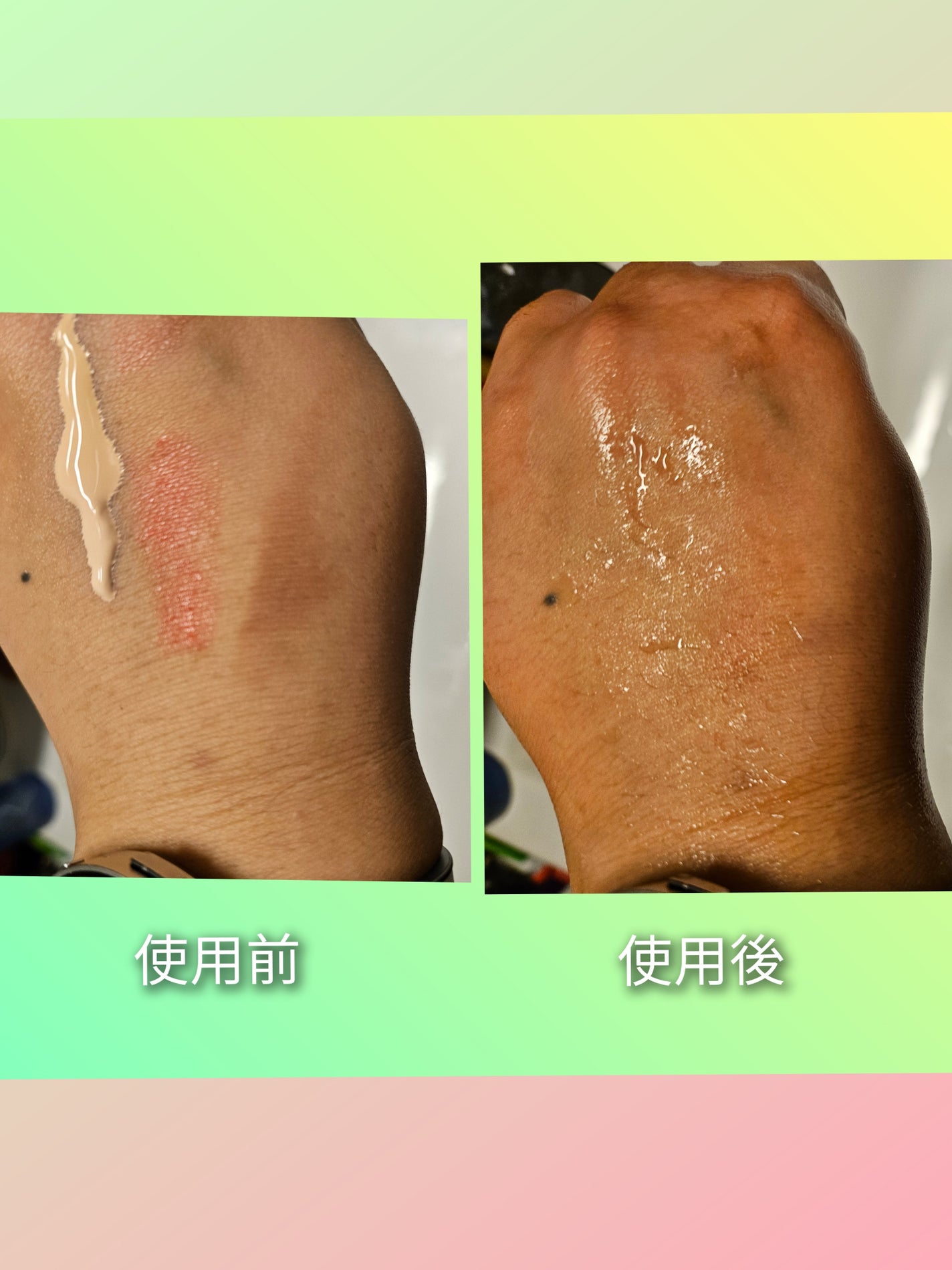 ボタニックジェルクレンザー/マデカダーマ/フェイスクリームを使ったクチコミ(3枚目)