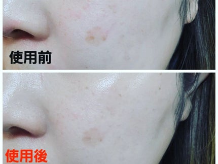 TRUECICA アクアカーミング日焼け止め/SOME BY MI/日焼け止めクリームを使ったクチコミ(4枚目)