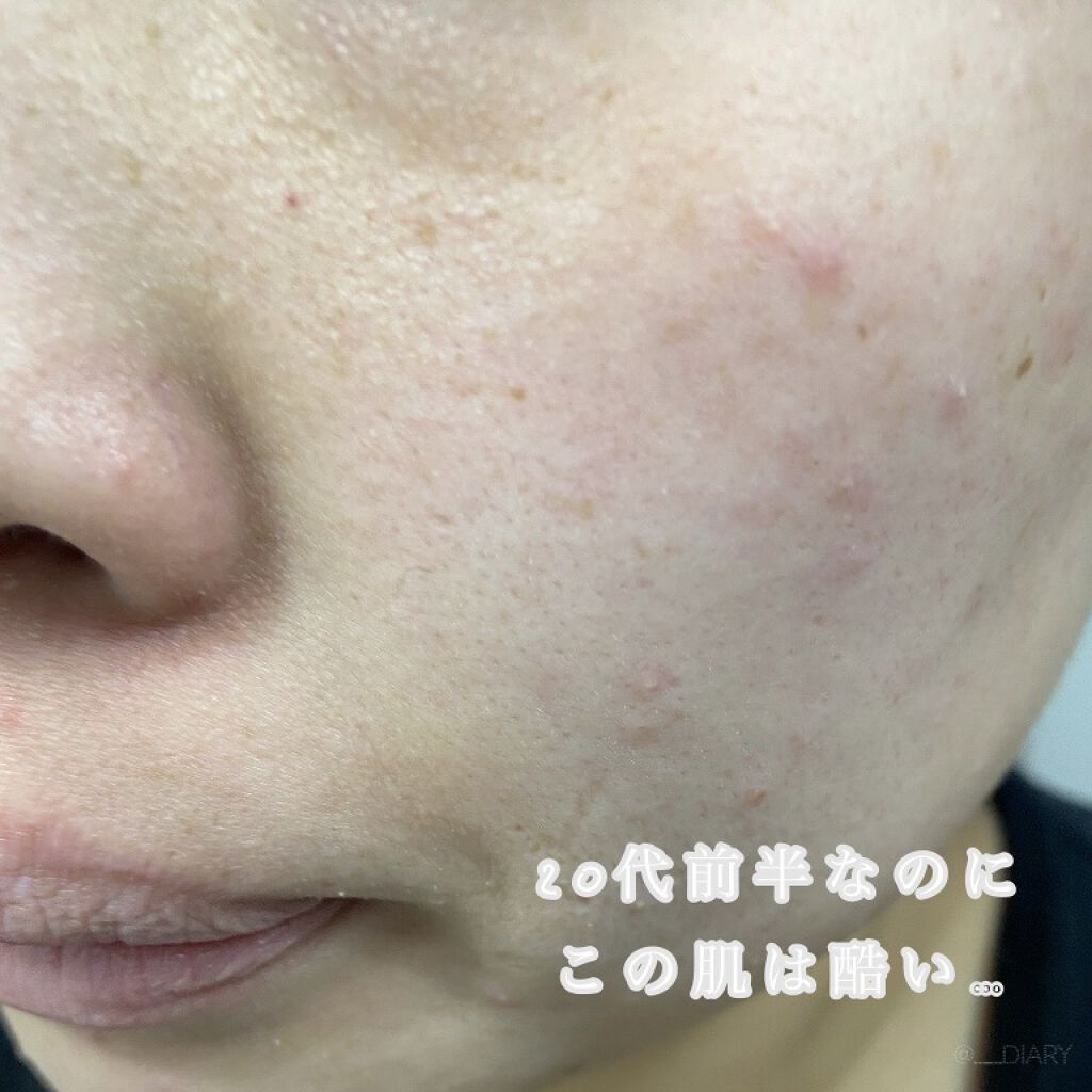 デュオ ザ クレンジングバーム ブラックリペア /DUO/クレンジングバームを使ったクチコミ（3枚目）