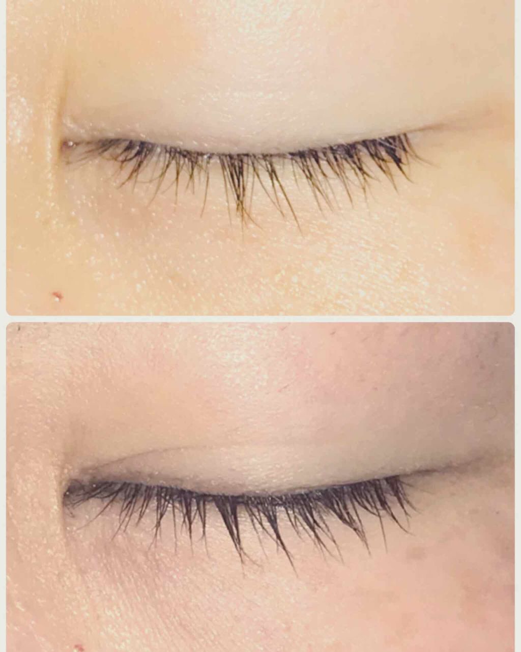 ローヤルゼリー配合 栄養ローション/DAISO/美容液を使ったクチコミ(1枚目)