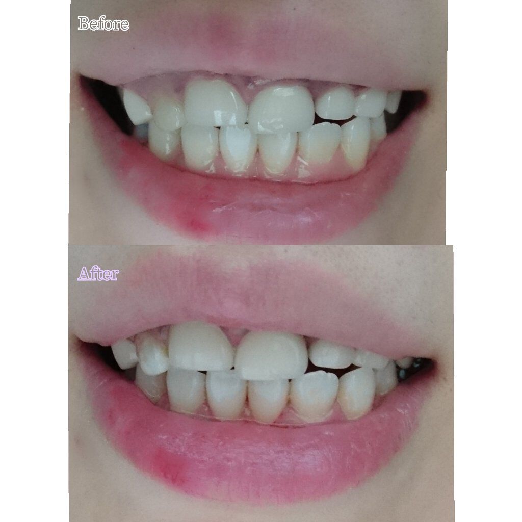 ðð®ðððð¢â¡ on LIPS ããã¯ããããããŸã@whitteessne_official..ãïŒ7æç®ïŒ