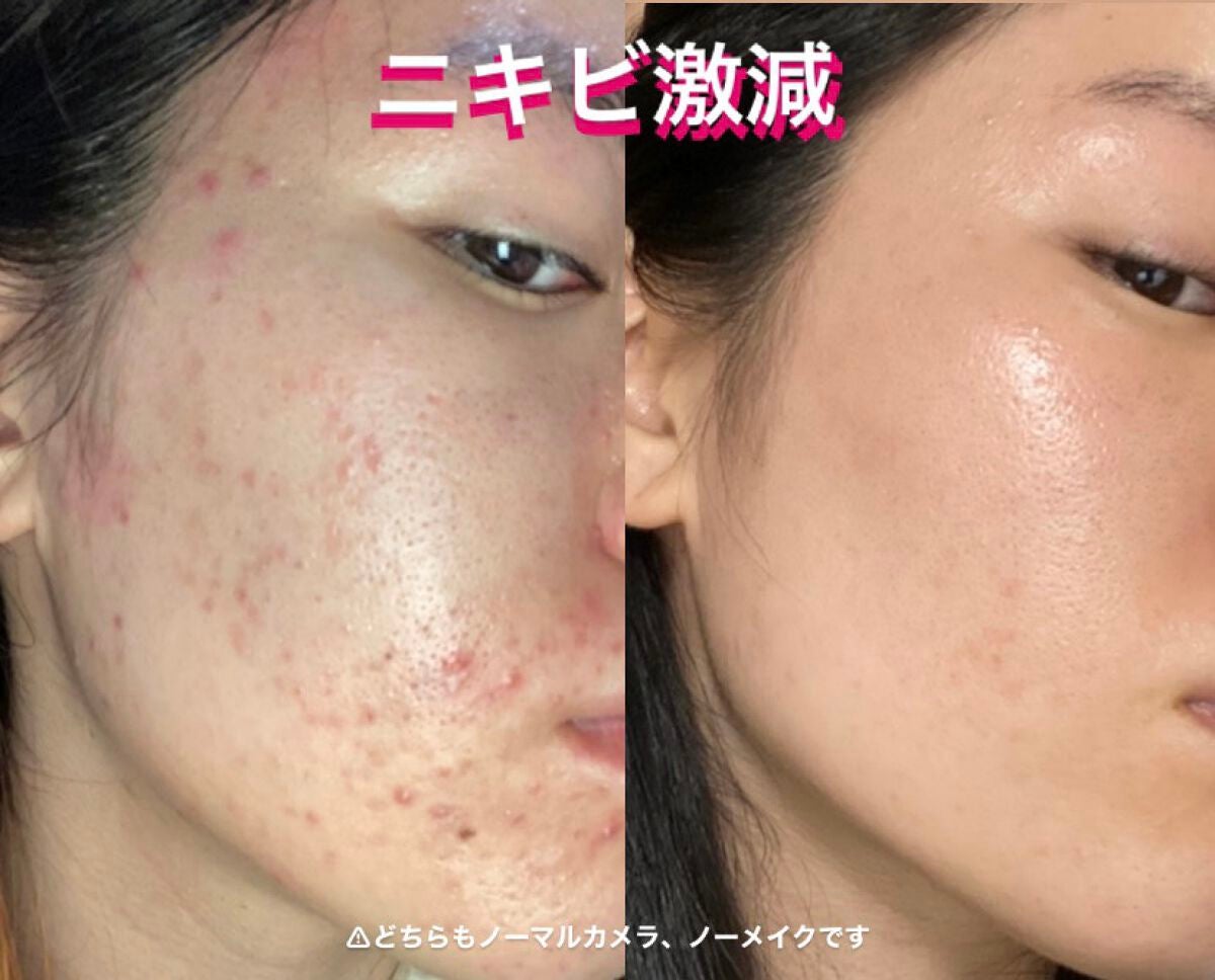 エリクシール シュペリエル クレンジングフォームⅡ N/エリクシール/洗顔フォームを使ったクチコミ(1枚目)